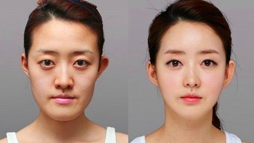 韩国女子整容前后的对比图, 让人不敢相信