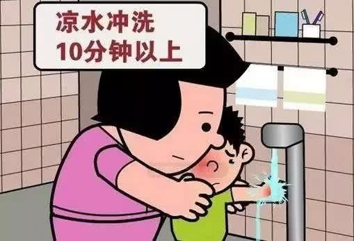 面对顾客轻微烧烫伤,店员该怎么处理?