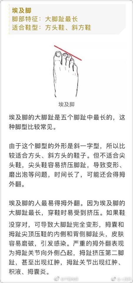 你是埃及脚,希腊脚还是罗马脚?不同脚型对应不同鞋型