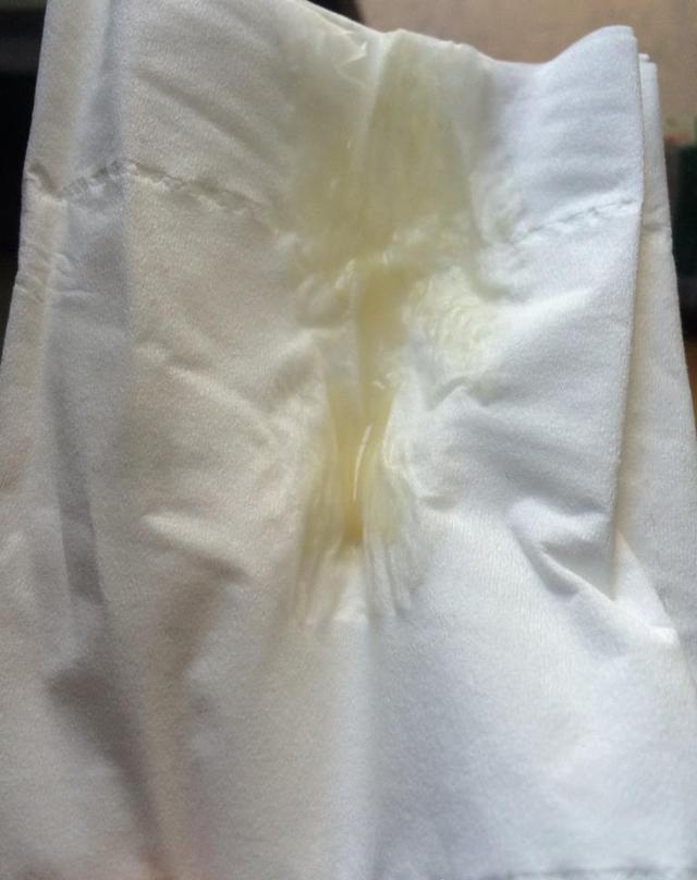 羊水破了的感觉真的是超乎我的想象