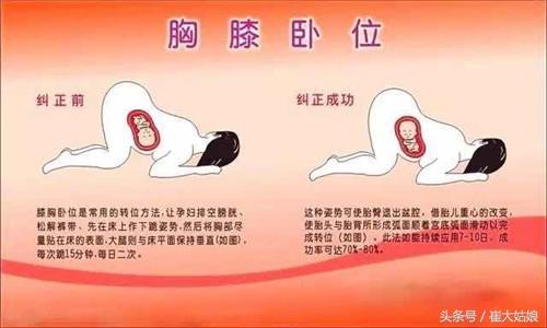 胎儿哪些姿势属于胎位不正?纠正方法有哪些 看