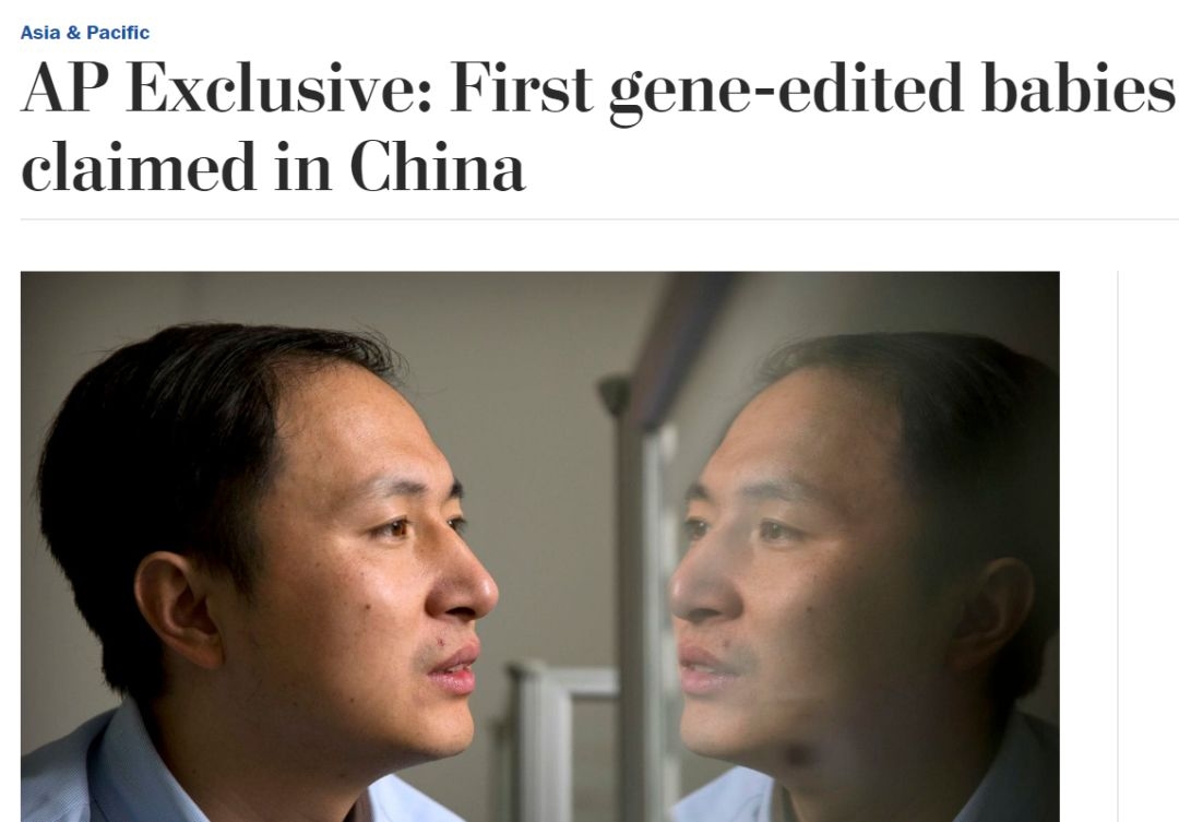 疯了 直接人体实验,免疫艾滋病 但全世界都在骂