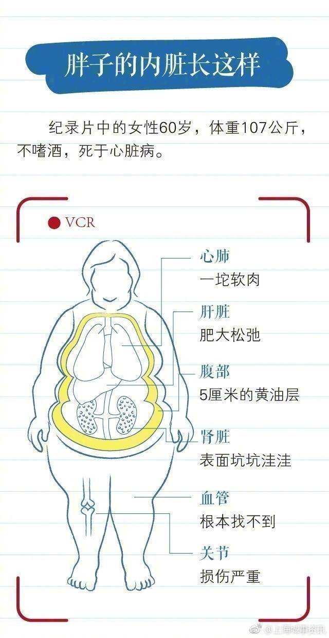 胖子的内脏长这样!一个公式算出肥胖程度