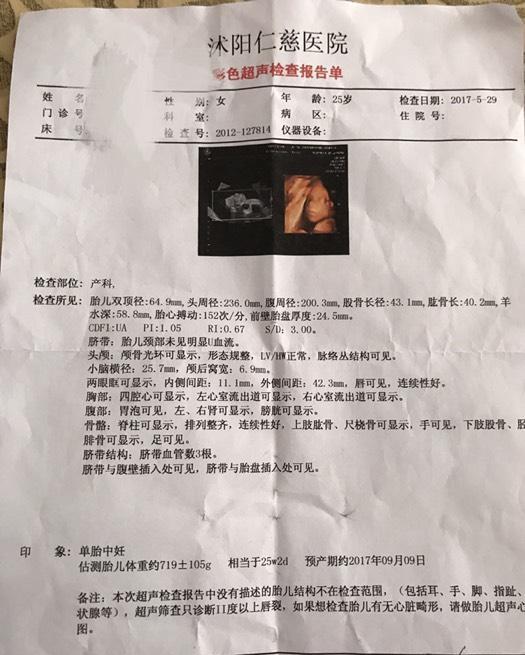 二胎四维归来依旧是男宝, 姐妹们来接好孕吧(附症状)