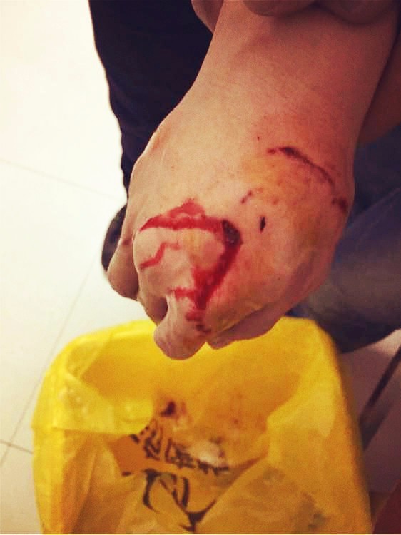 给狗狗剪指甲,狗狗突然张嘴咬伤主人,过年有狗肉火锅吃了!