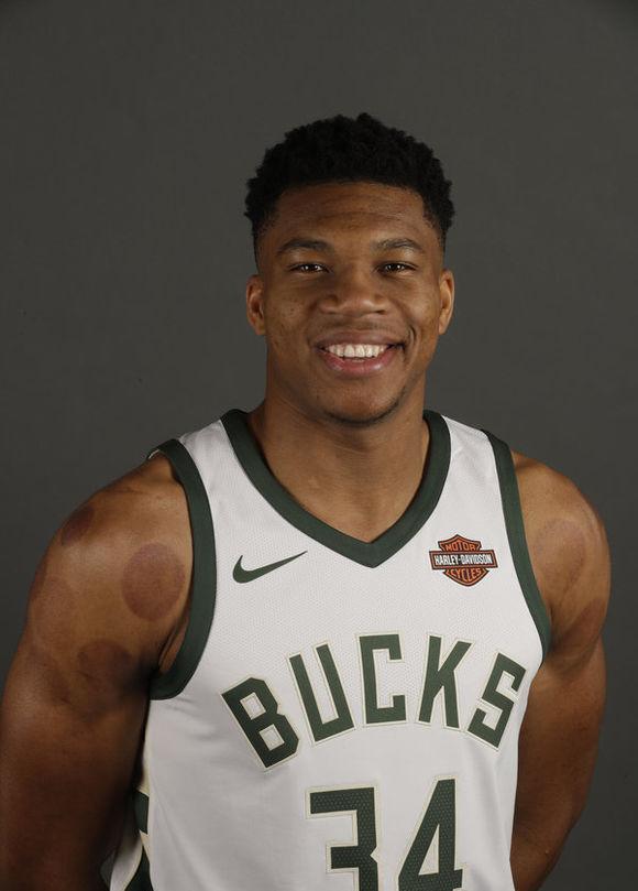 詹姆斯用拔火罐恢复身体 还有哪些NBA球员被