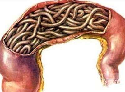 4岁半孩子经常肚子疼,奶奶带去医院,检查结果