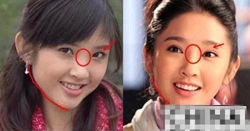 她整容又被扒出, 这次有整容前照片, 有图有真相, 快来看