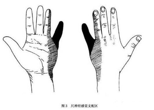 小拇指经常发麻别大意，可能是这3种疾病，不知道的宝妈太亏了