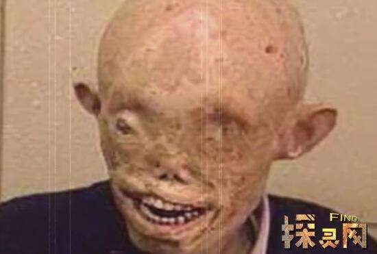 �㵺�������߹���ֲ�, �˷�������˻����Ϊ����