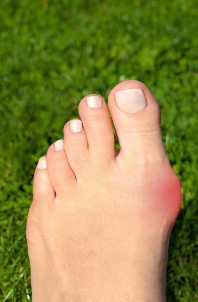 常穿高跟鞋让脚趾外翻!盘点娱乐圈4位脸美脚