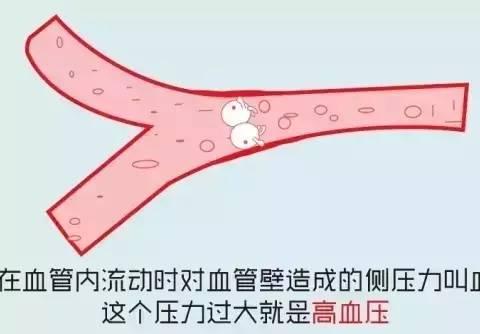 图解高血压的科普知识