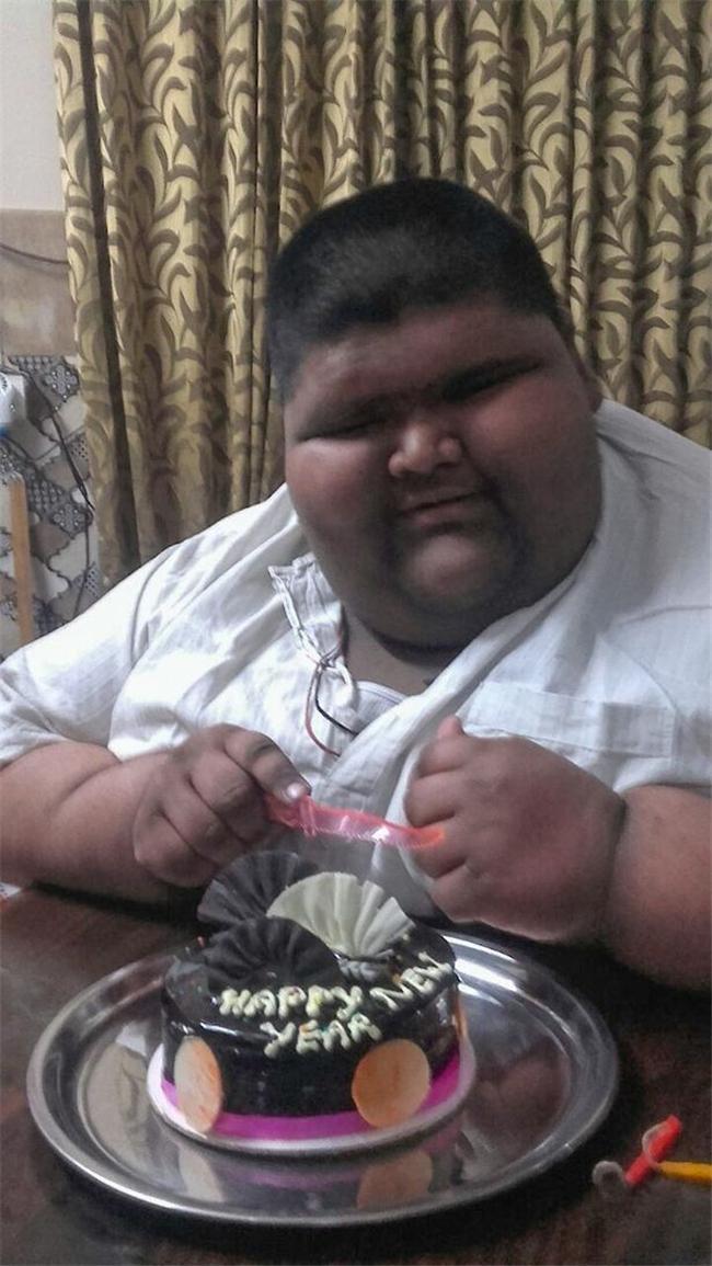14岁474斤,被称为"世界上最胖的孩子",胖到眼睛都睁不