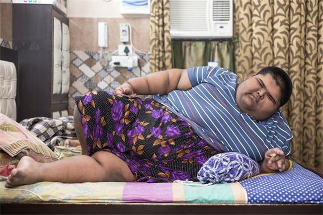 14岁474斤,被称为"世界上最胖的孩子",胖到眼睛都睁不开|儿子|体重