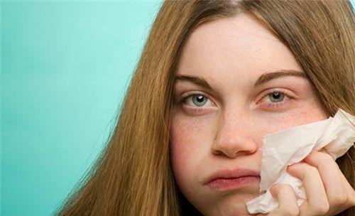 朵嘉浓宋晶:脸上频繁过敏有哪两种原因造成的