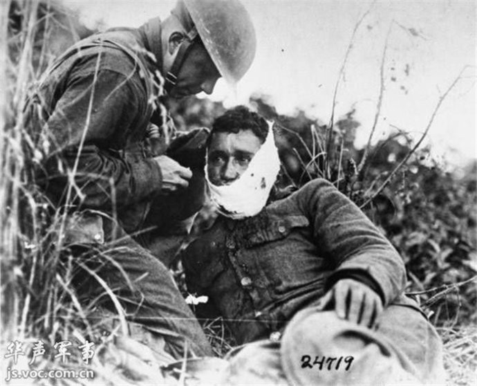 第一次世界大战中的战场救护和伤员图片等