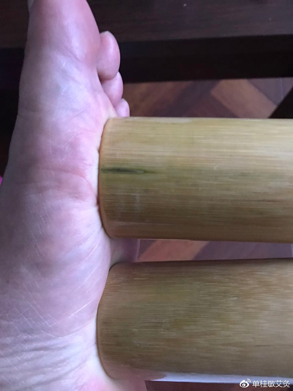 足跟痛如何艾灸治疗?