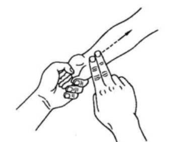 岳阳医院|海派小儿推拿退热公益讲座活动回顾