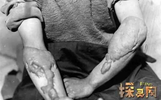 �㵺�������߹���ֲ�, �˷�������˻����Ϊ����