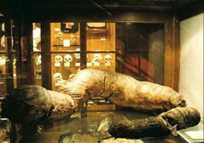 胆小慎入!费城马特博物馆惊悚展品