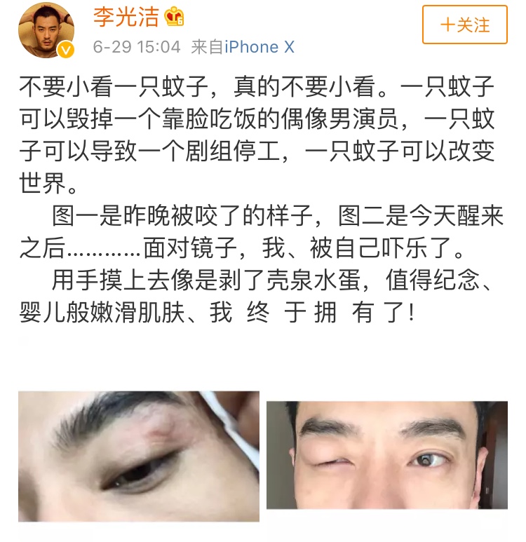 李光潔因被蚊子咬而導致全劇組停工，網友的評論夠你笑上一整年！