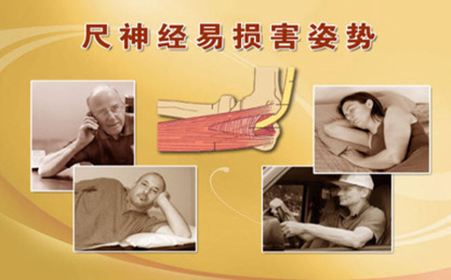 小拇指经常发麻别大意，可能是这3种疾病，不知道的宝妈太亏了