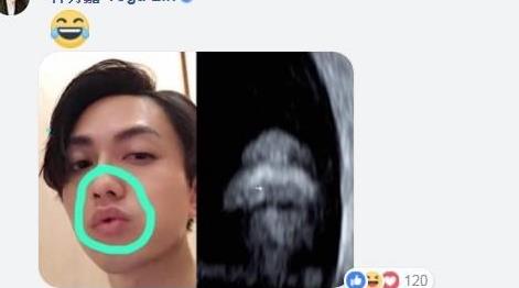 丁文琪「7个月巨肚」现形！卸货倒数罕见曝裸肚照
