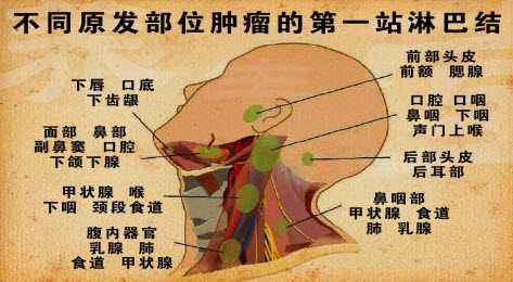 淋巴结炎图片_纵览新闻