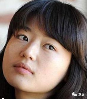 孙艺珍鼻子上惊现隆鼻刀疤 南韩第一纯天然美女人