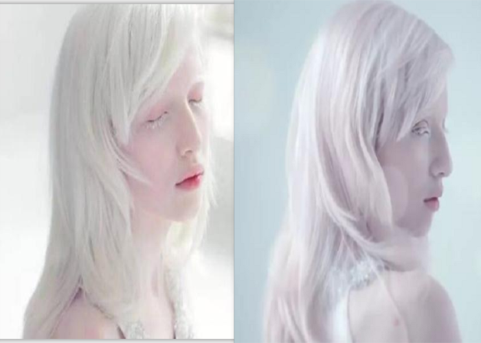 乌克兰一白化病少女,天生紫瞳雪白皮肤,如今还成为一名模特!
