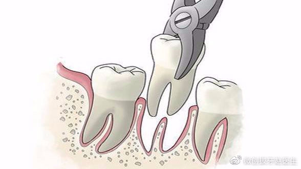 矫正牙齿必须拔牙吗？淄博有能不拔牙矫正的医院吗？