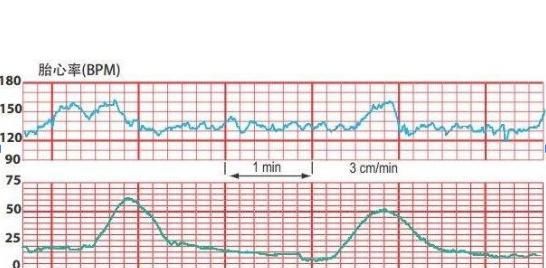 孕期若收到这3个“信号”，或许孕妈会如愿生下“男宝宝”，恭喜