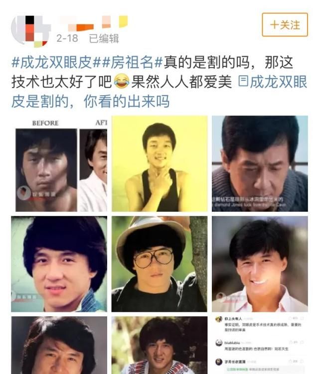 同样是整形 为什么男明星不容易被看出