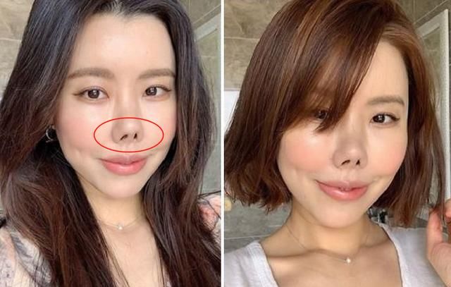 于朦胧有整容吗