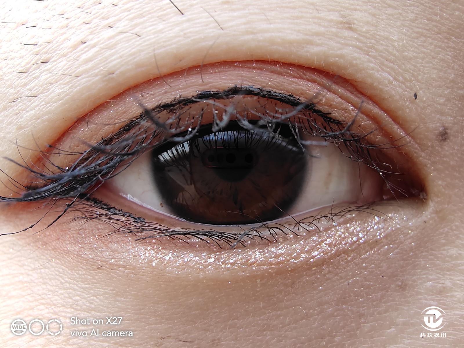 手术后看瞳孔啥意思 7737-hvsckth0544313.jpg