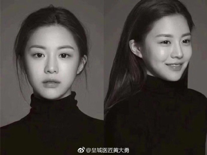 韩国最新整容范本出炉，这次中韩审美竟然一致了，整容前照片亮了