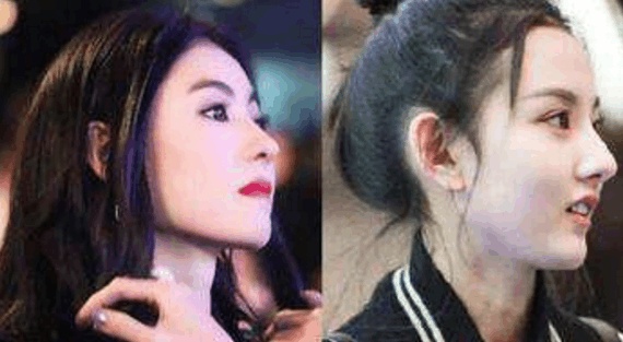 韩国最新整容范本出炉，这次中韩审美竟然一致了，整容前照片亮了
