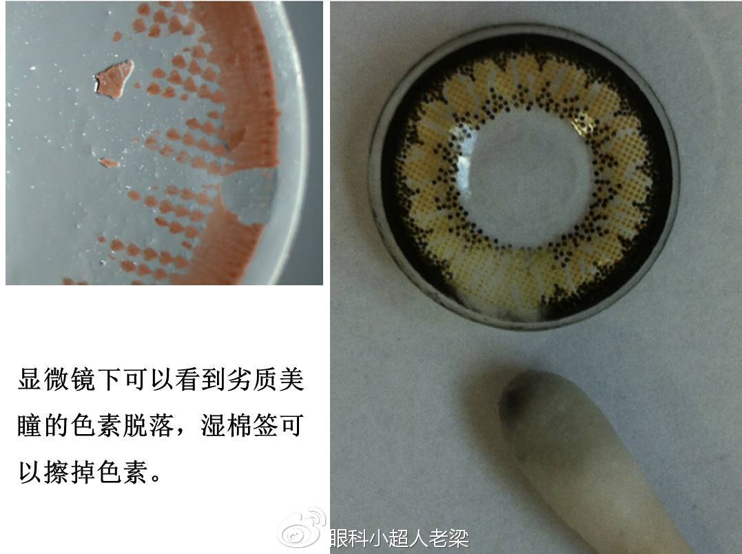 小心挑选美瞳！可能危害眼睛！