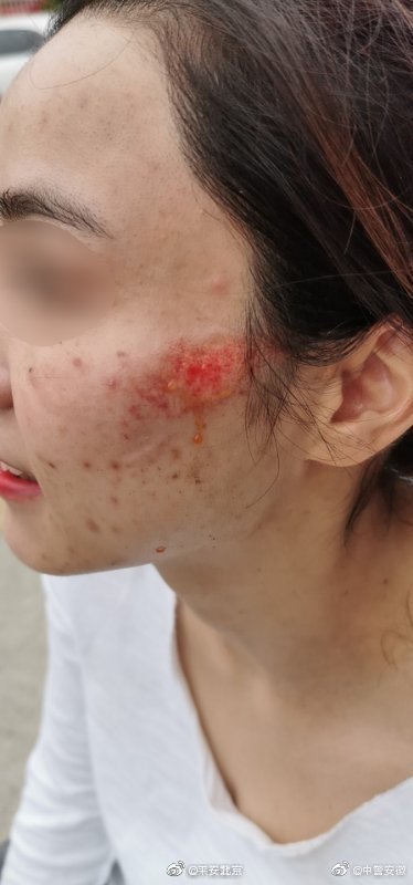 女警主动请缨引色狼出洞 被拖拽数米多处负伤