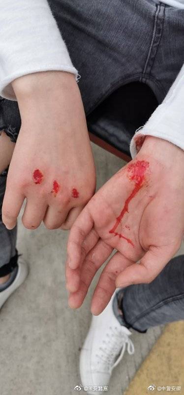 女警主动请缨引色狼出洞 被拖拽数米多处负伤