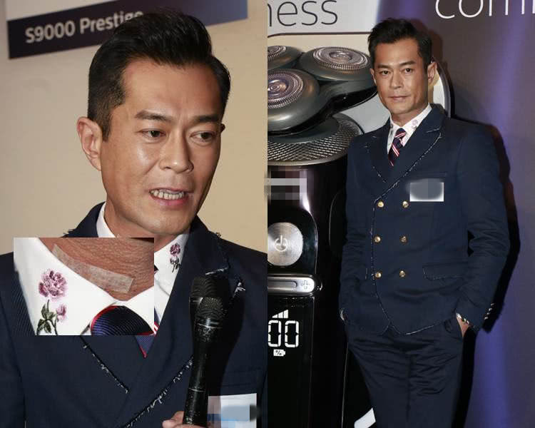 协会成员开派对庆祝古天乐拿奖 古仔脖子上还贴着胶布遮盖伤口