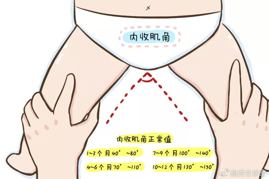 "我家宝宝肌张力高,网上查,说是脑瘫"