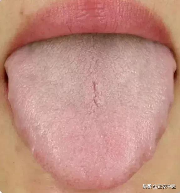 湿重乏力的人，推荐几个有效的祛湿保健方法