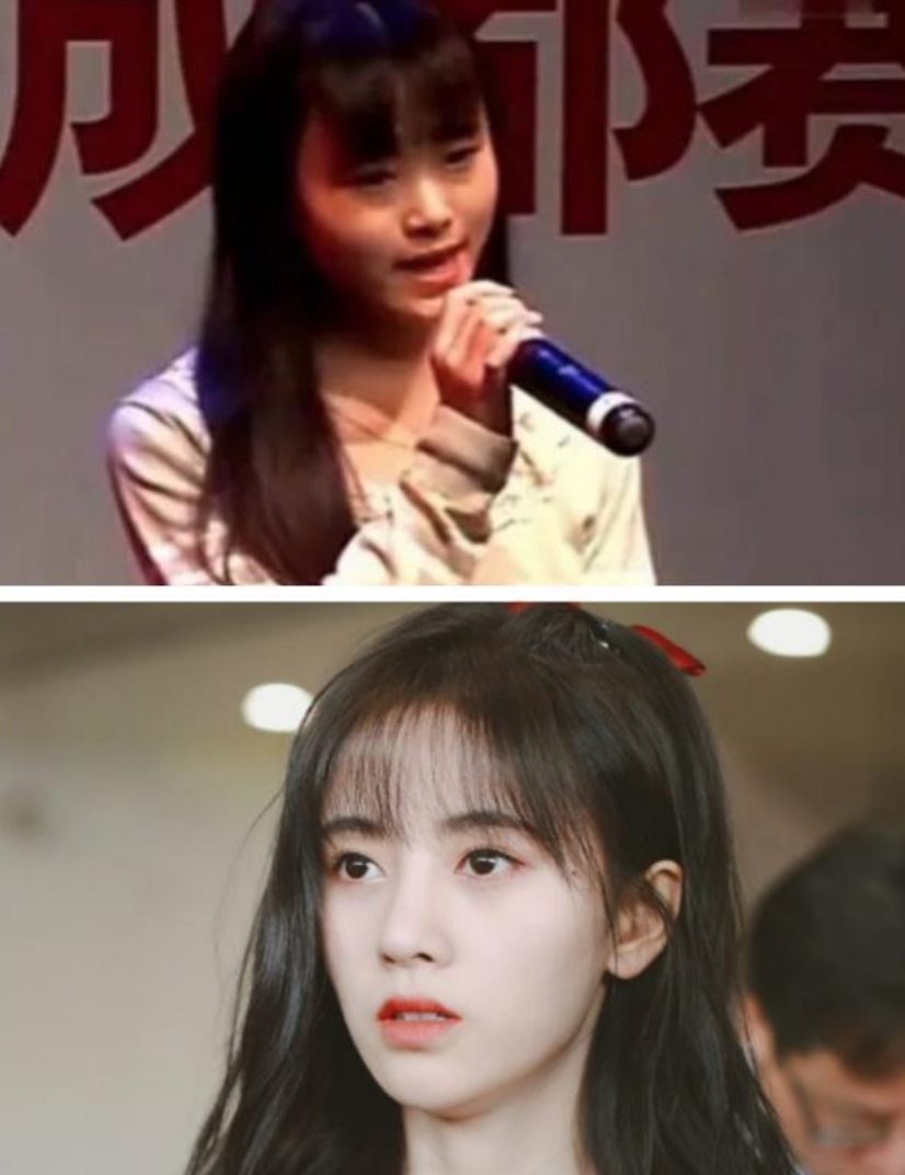 鞠婧祎自杀式整容？鼻子薄的像纸还透光！医生建议这样复原...