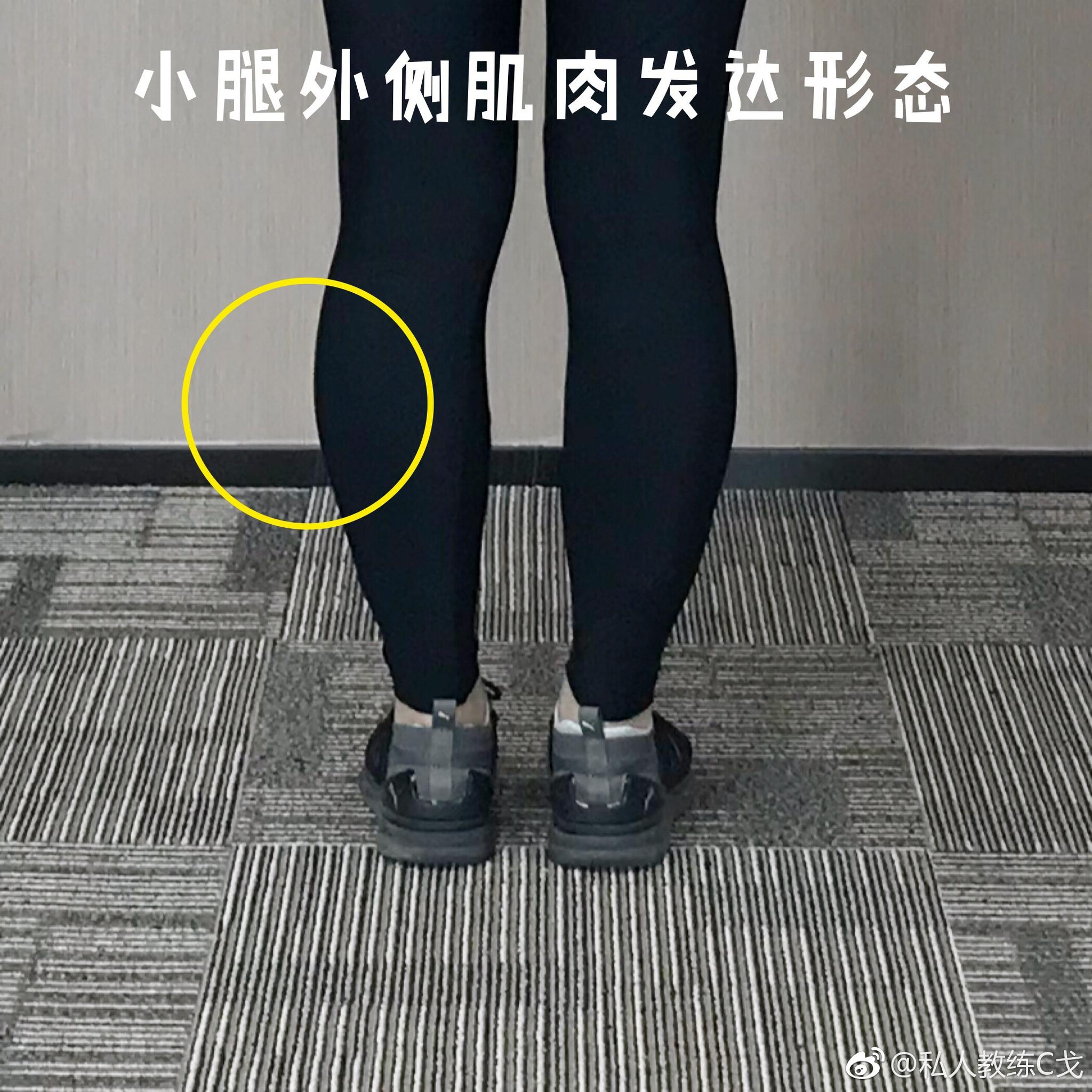 小腿外侧肌肉发达