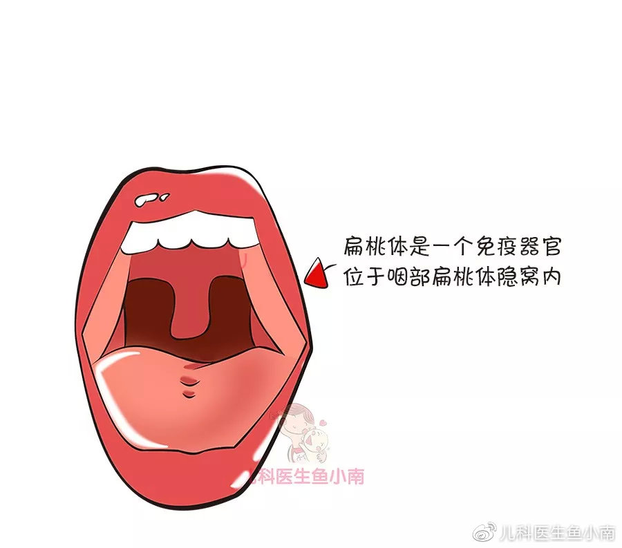 宝宝扁桃体老发炎,切还是不切?医生:看这5点