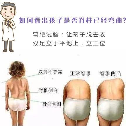 小心!这很可能是脊柱侧弯!