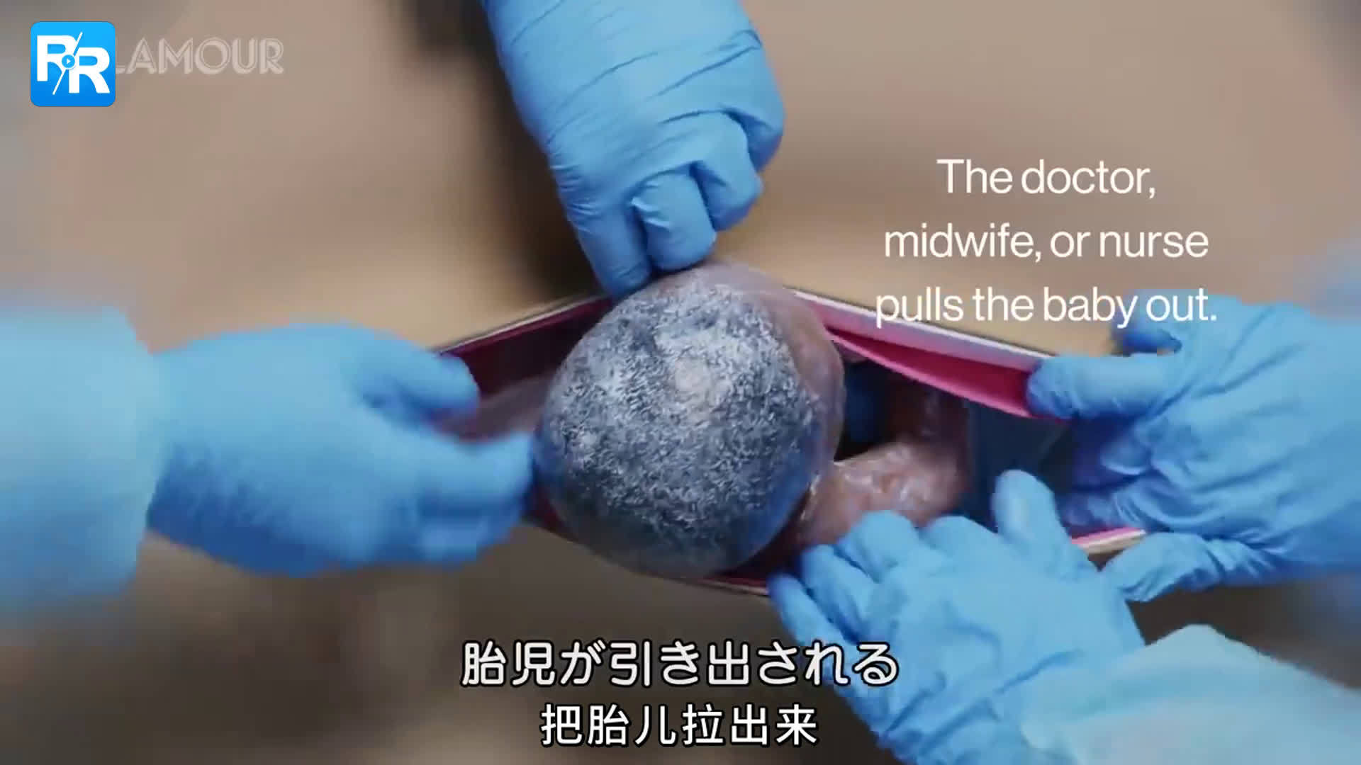 完美还原剖腹产过程!带你了解产前要做哪些准备