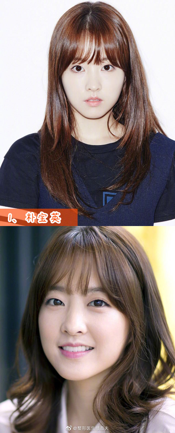 韩国网友发起的"最美单眼皮女星"投票
