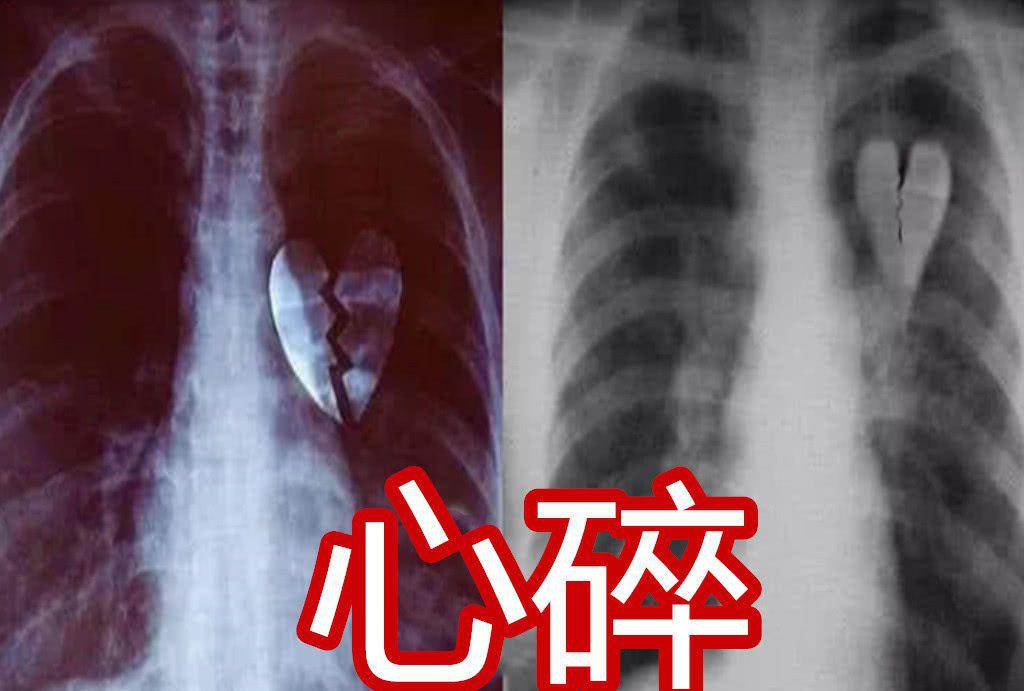 同是"x光",忍了易烊千玺,忍了心碎,秀儿:鳄鱼是认真的